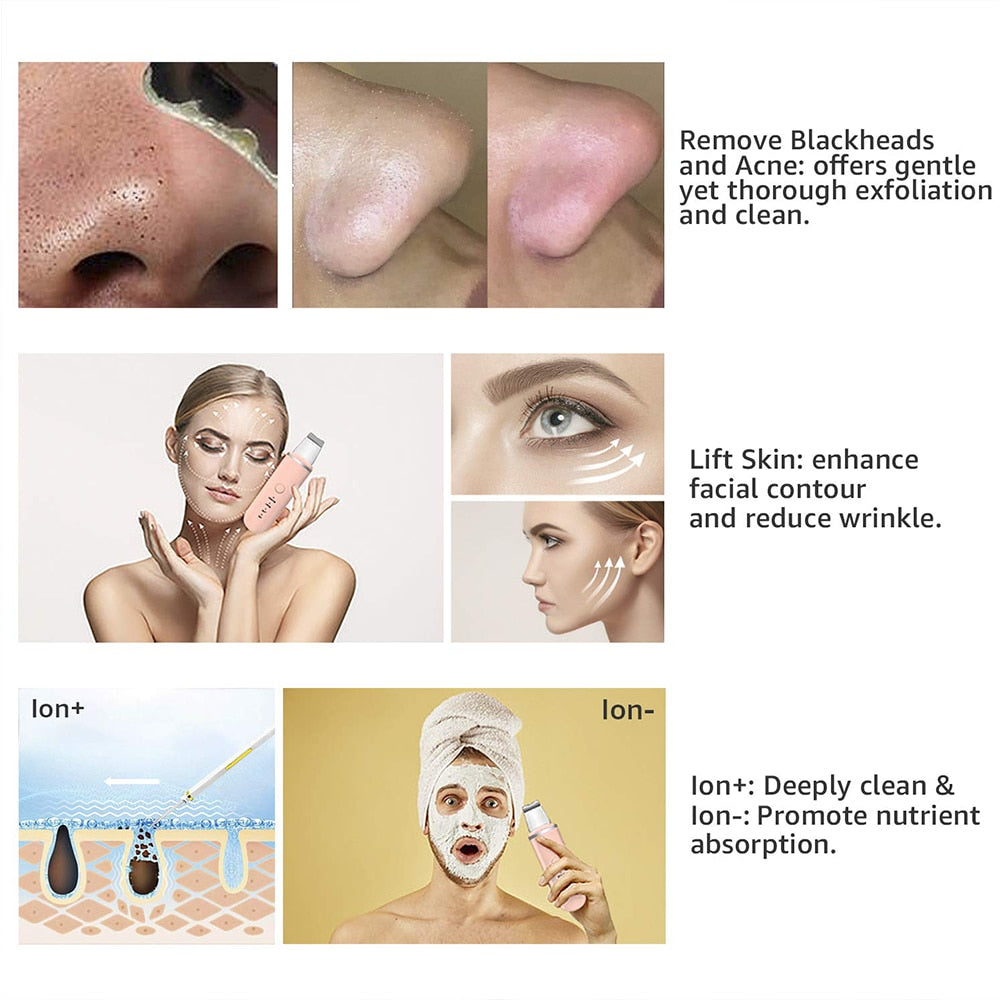 HexoSkin™ - Ultrasonic Blackhead Removing Skin Scrubber