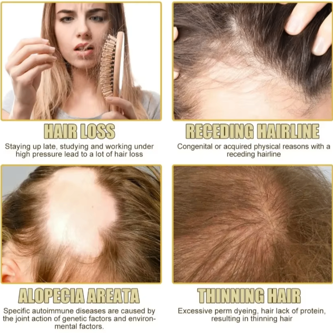 InspireMist™ Organic Natural Hair Restoration and Growth Oil