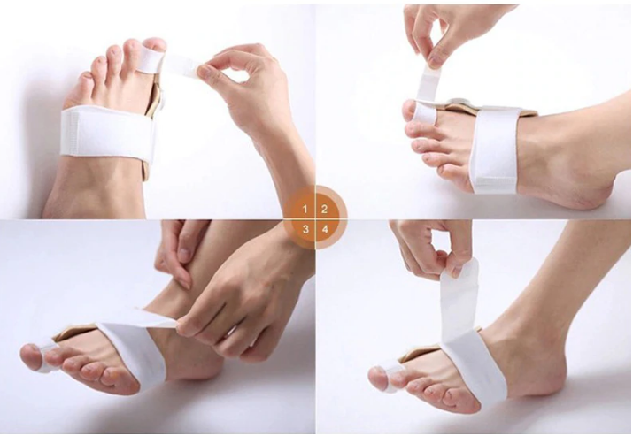 Best Orthopedic Bunion Corrector - Non-Surgical Natural Treatment & Relief - Westfield Retailers