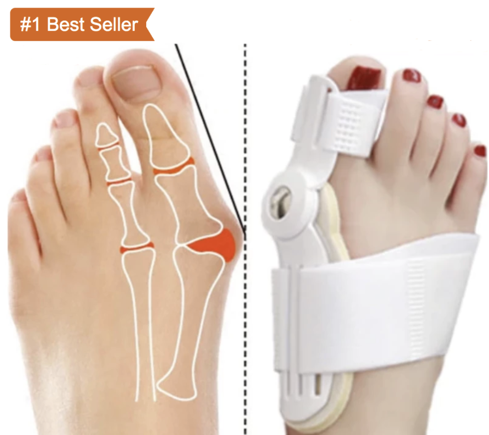 Best Orthopedic Bunion Corrector - Non-Surgical Natural Treatment & Relief - Westfield Retailers
