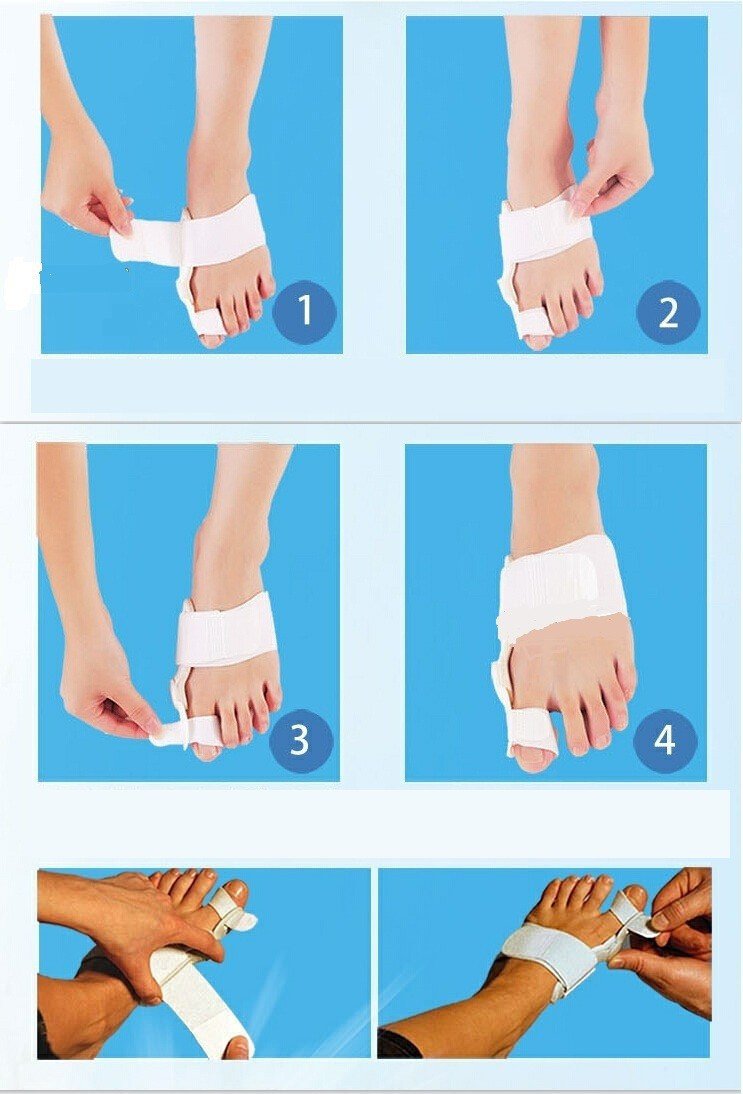 Best Orthopedic Bunion Corrector - Non-Surgical Natural Treatment & Relief - Westfield Retailers