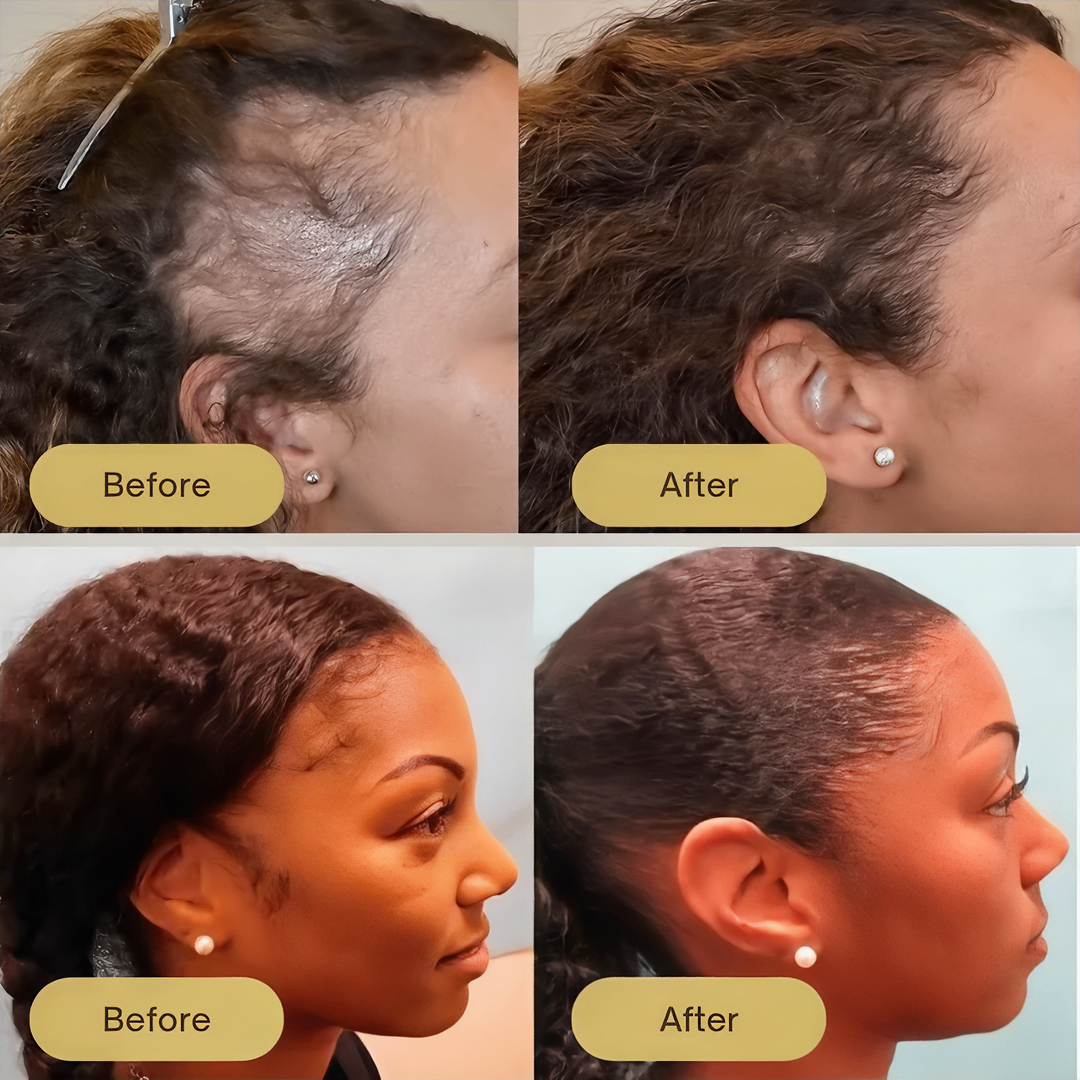 InspireMist™ Organic Natural Hair Restoration and Growth Oil