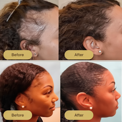 InspireMist™ Organic Natural Hair Restoration and Growth Oil