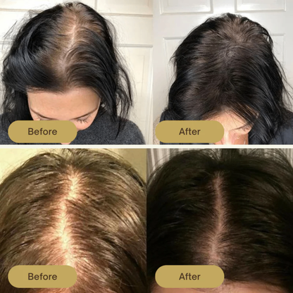 InspireMist™ Organic Natural Hair Restoration and Growth Oil