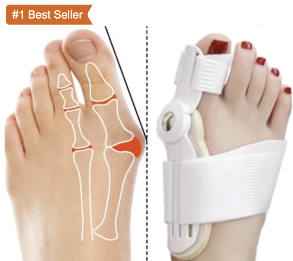 Best Orthopedic Bunion Corrector -  Non-Surgical Natural Treatment & Relief - Westfield Retailers