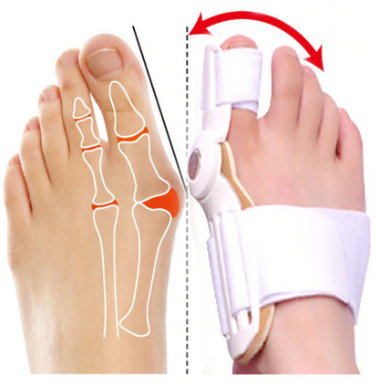 Best Orthopedic Bunion Corrector -  Non-Surgical Natural Treatment & Relief - Westfield Retailers