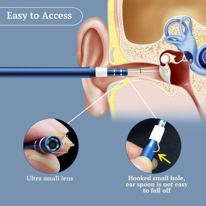 Premium Digital Phone Otoscope Camera 3 in 1 - Westfield Retailers