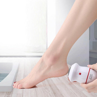 Premium Portable Electric Foot Callus Remover - Westfield Retailers