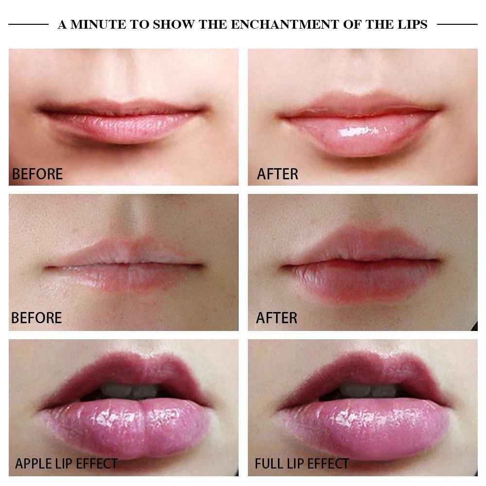 Premium Lip Plumper Handheld Device - Westfield Retailers